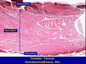 Corazon