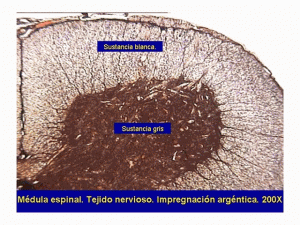 nerviosootro1